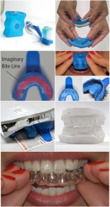 Smile Brilliant Teeth Whitening