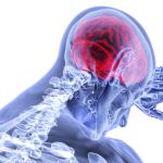 body inflammation