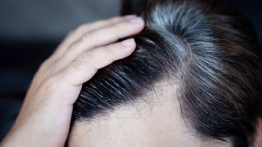 wellhealthorganic.com/know-the-causes-of-white-hair-and-easy-ways-to-prevent-it-naturally